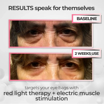 Ahsim Studio™ EMS Eye Massager