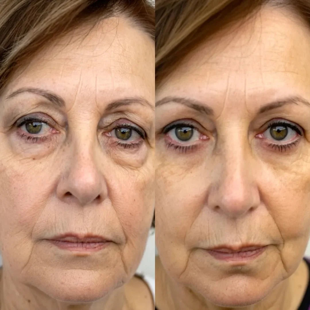 Ahsim Studio™ EMS Eye Massager